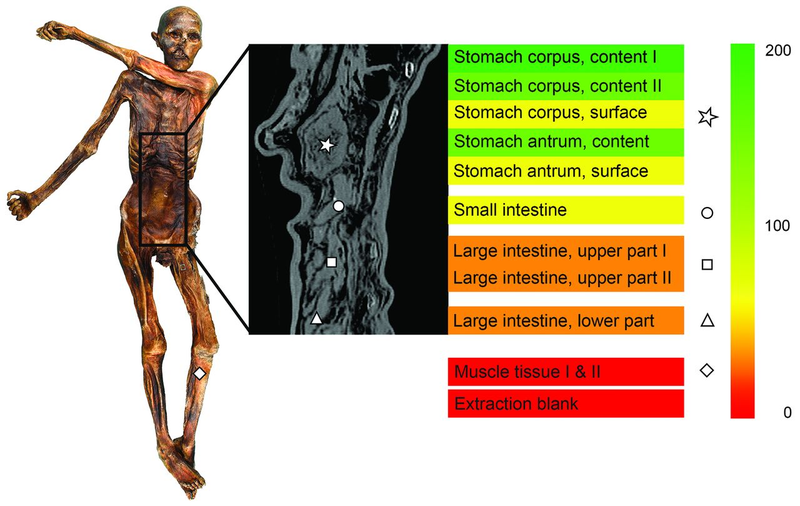 Illustration for article titled Ötzi the Iceman's Gut Bacteria Can Help Us Trace Early Human Migration